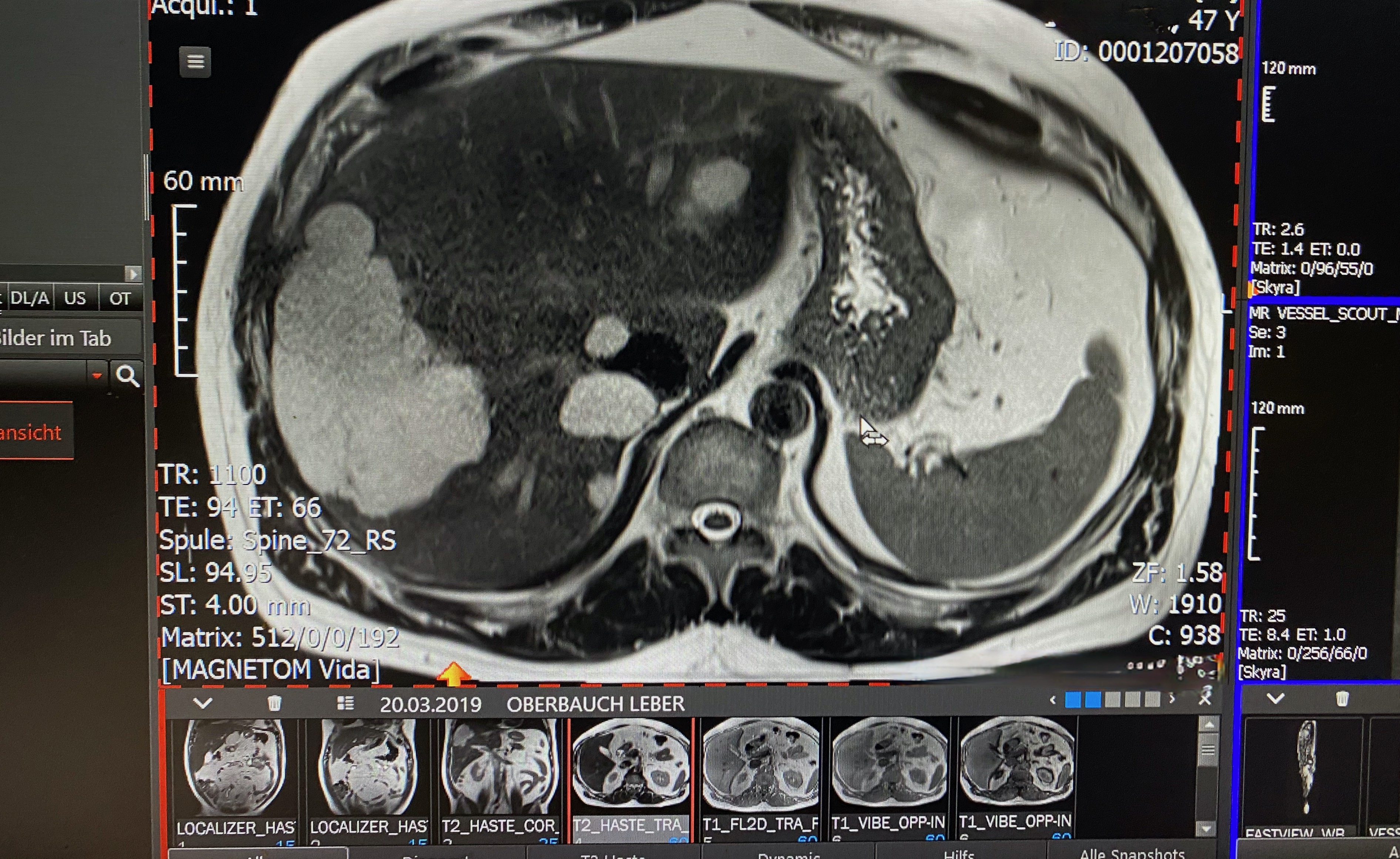 Facharzt für Radiologie oder Nuklearmedizin (m/w/d) als regelmäßige Praxisvertretung gesucht