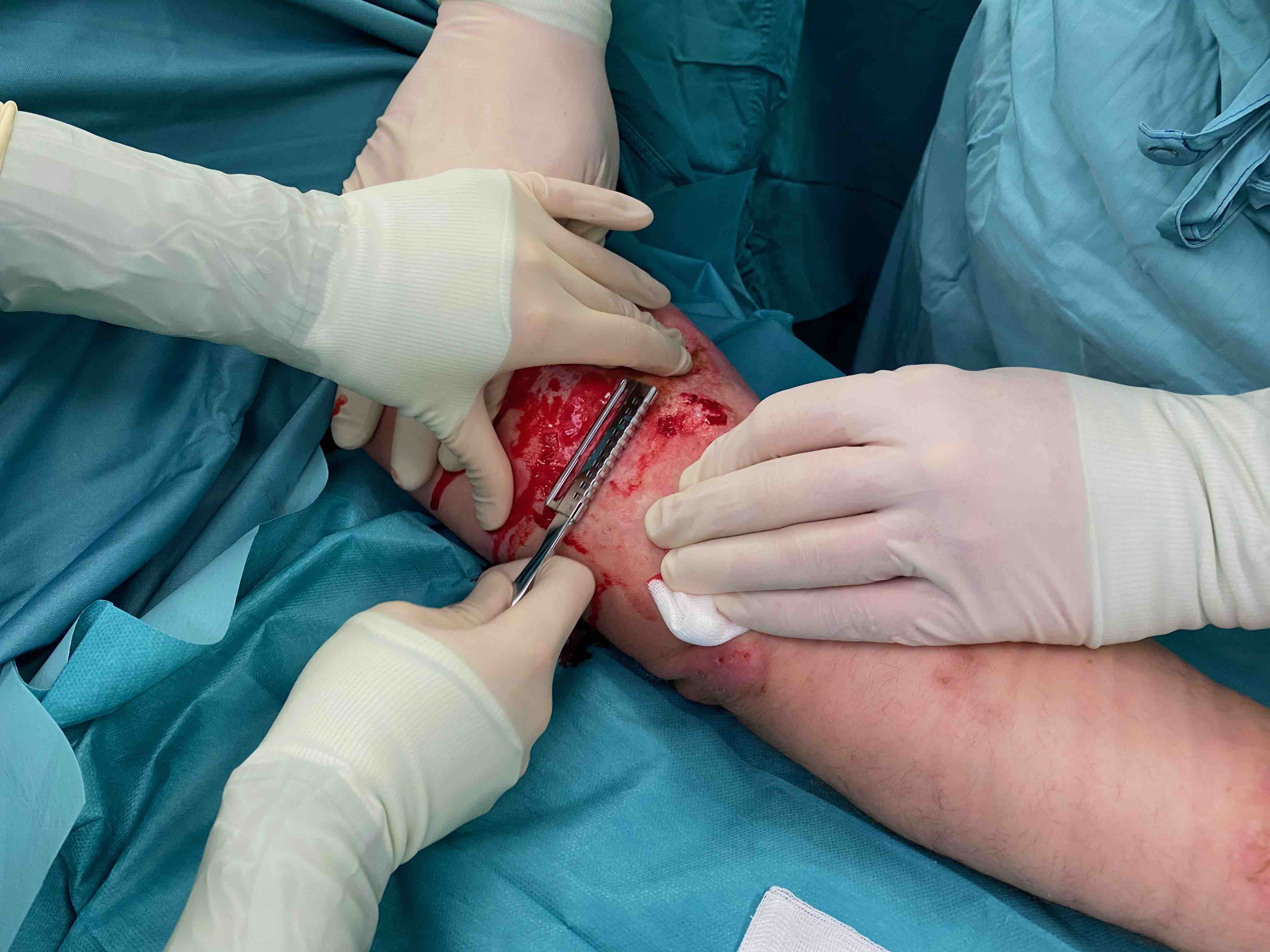 WB-Assistent/in für große Allgemeinmedizinisch-Chirurgische Praxis in Hessen gesucht