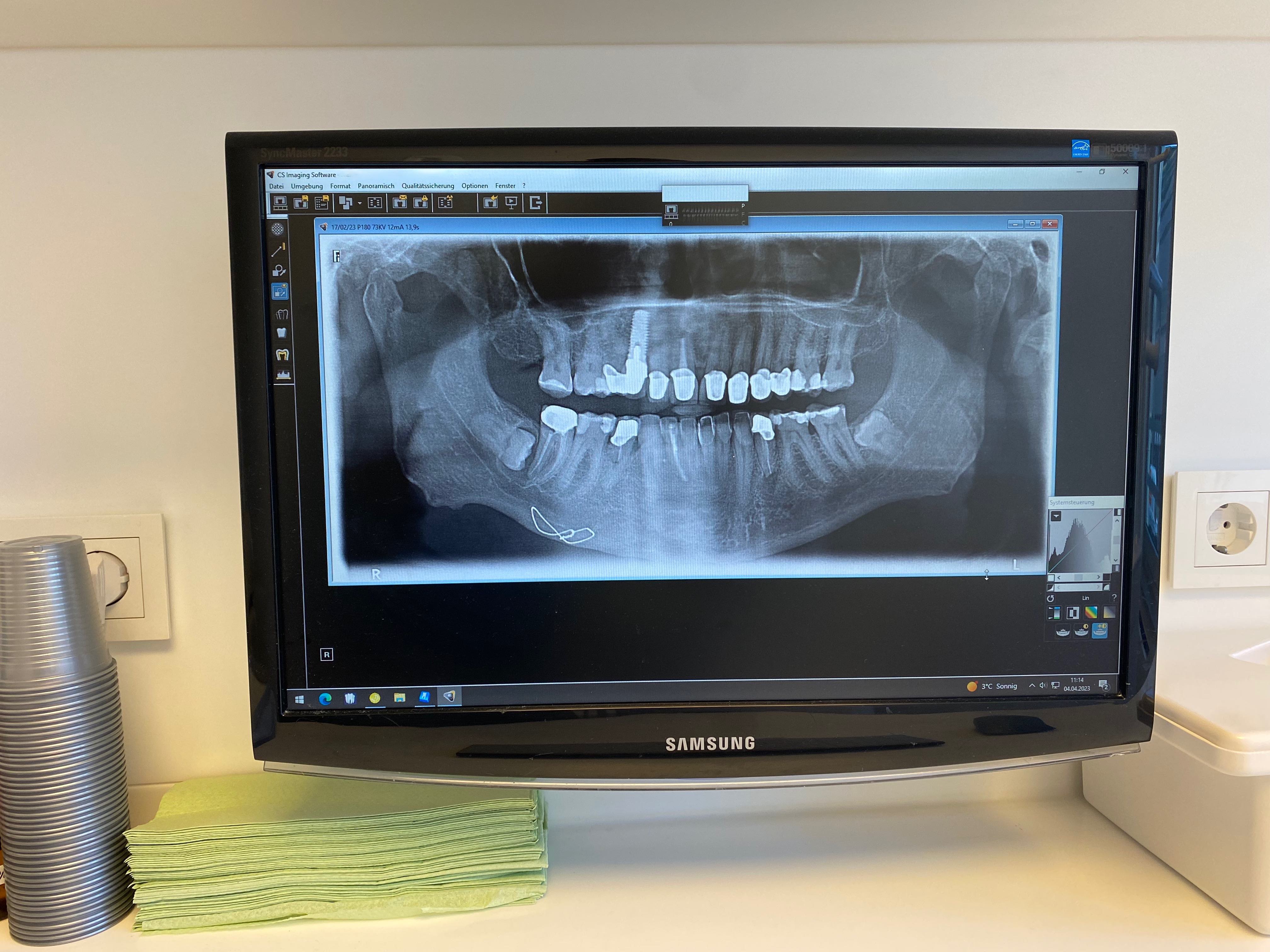 Innenstadtlager Fürstenau Praxisfläche ca. 200 m²