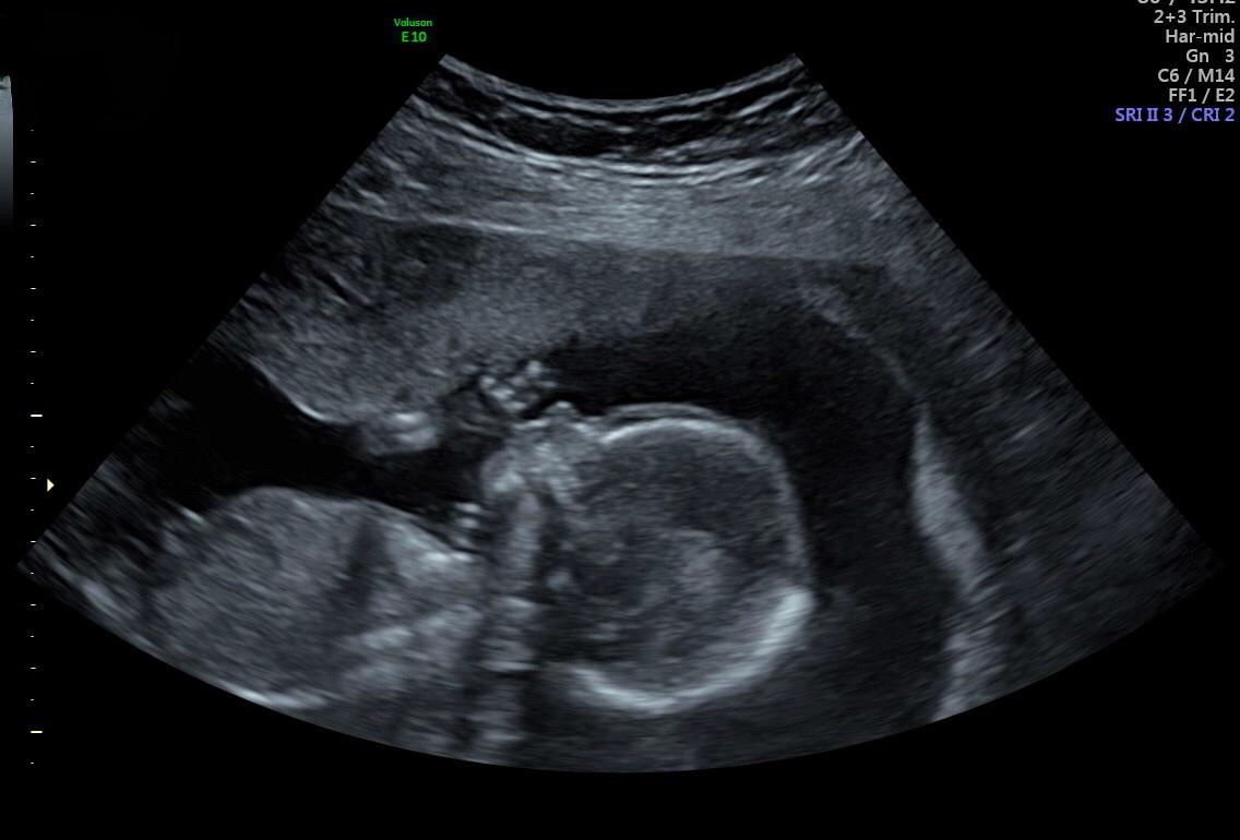 Gynäkologische Praxisabgabe ab 01/26 in Oberbayern