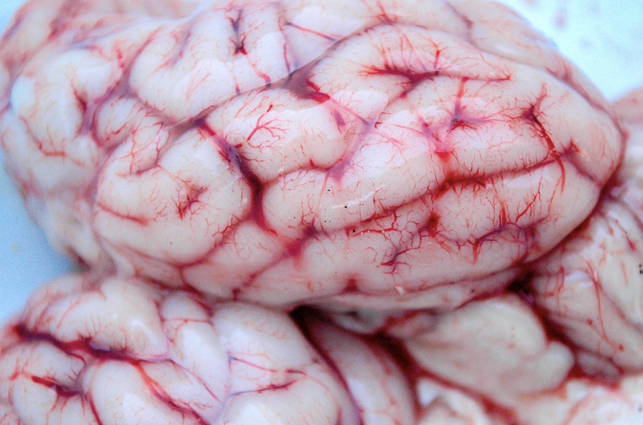 Phlebologe sucht Neurologe (bevorzugt) als Praxisneugründung in Meckenheim